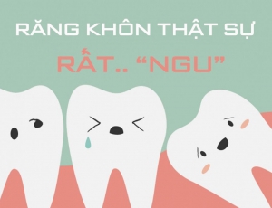 RĂNG KHÔN VÀ NHỮNG ĐIỀU CẦN BIẾT